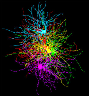 thalamocortical relay cells